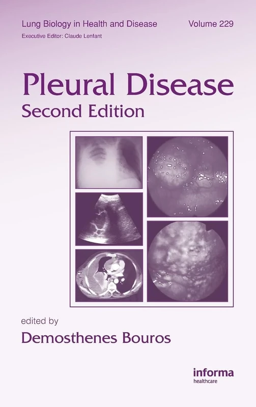 Pleural Disease: 229 (Lung Biology in Health and Disease)
