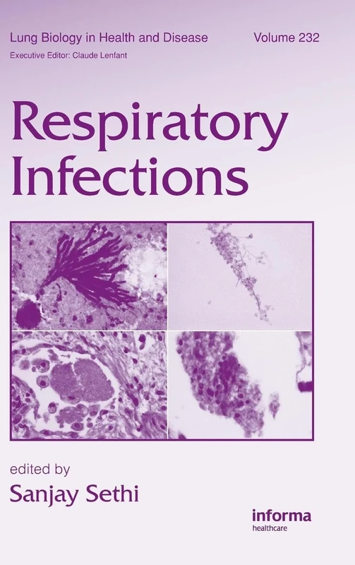 Respiratory Infections: 232 (Lung Biology in Health and Disease)