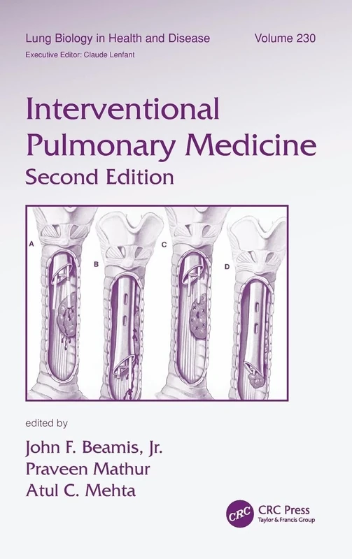 Interventional Pulmonary Medicine: 230 (Lung Biology in Health and Disease)