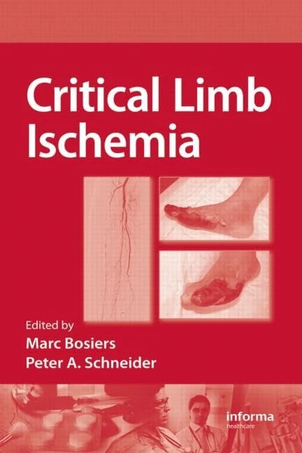 CRC Press Critical Limb Ischemia - Medical Treatment Guide - Image 1