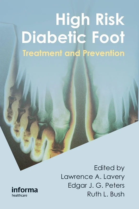 High Risk Diabetic Foot: Treatment and Prevention