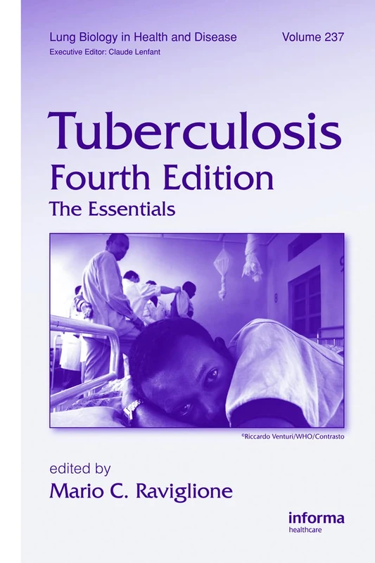 Tuberculosis: The Essentials, Fourth Edition: 237 (Lung Biology in Health and Disease)