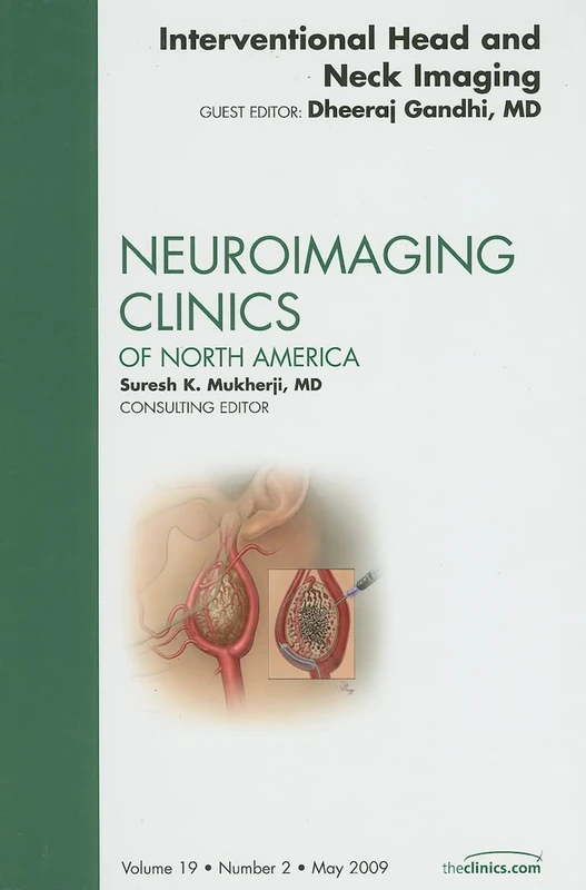 Interventional Head and Neck Imaging, An Issue of Neuroimaging Clinics (Volume 19-2) (The Clinics: Radiology, Volume 19-2)