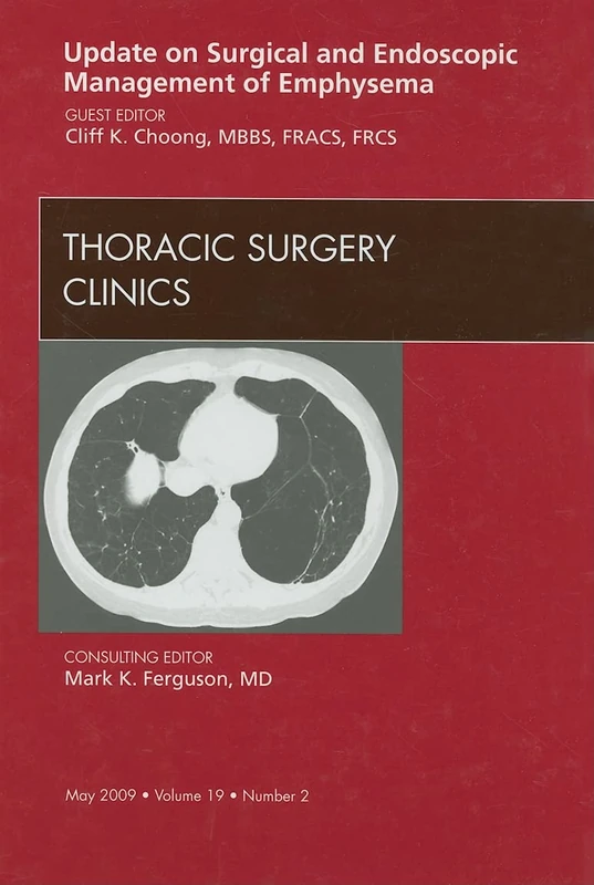 Update on Surgical and Endoscopic Management of Emphysema, An Issue of Thoracic Surgery Clinics (Volume 19-2) (The Clinics: Surgery, Volume 19-2)