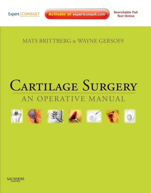 Cartilage Surgery: An Operative Manual, Expert Consult: Online and Print - Image 1