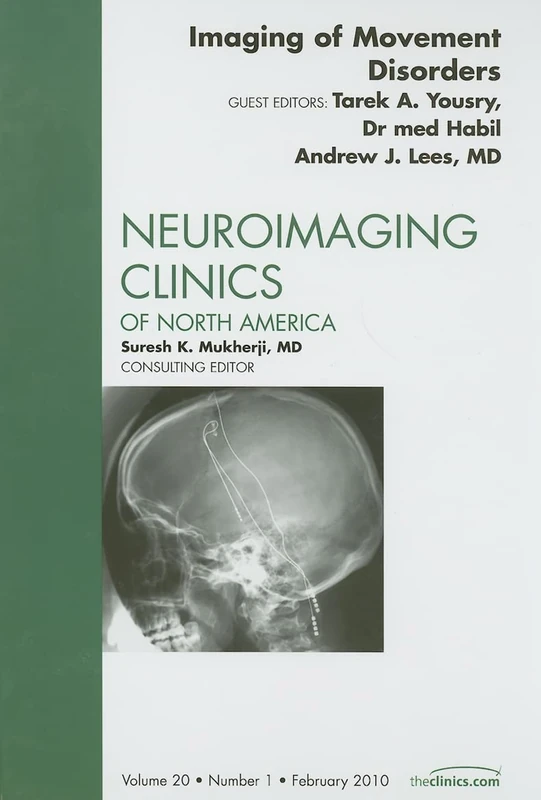 Imaging of Movement Disorders, An Issue of Neuroimaging Clinics (Volume 20-1) (The Clinics: Radiology, Volume 20-1)