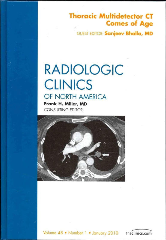 Thoracic Multidetector CT Comes of Age, An Issue of Radiologic Clinics of North America (Volume 48-1) (The Clinics: Radiology, Volume 48-1)