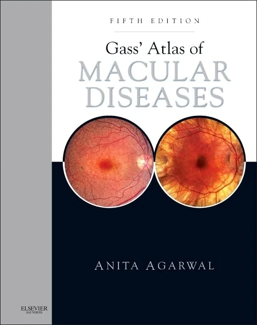 Gass' Atlas of Macular Diseases: 2-Volume Set - Expert Consult: Online and Print: 1-2