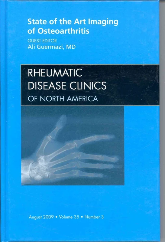 State of the Art Imaging of Osteoarthritis, An Issue of Rheumatic Disease Clinics (Volume 35-3) (The Clinics: Internal Medicine, Volume 35-3)