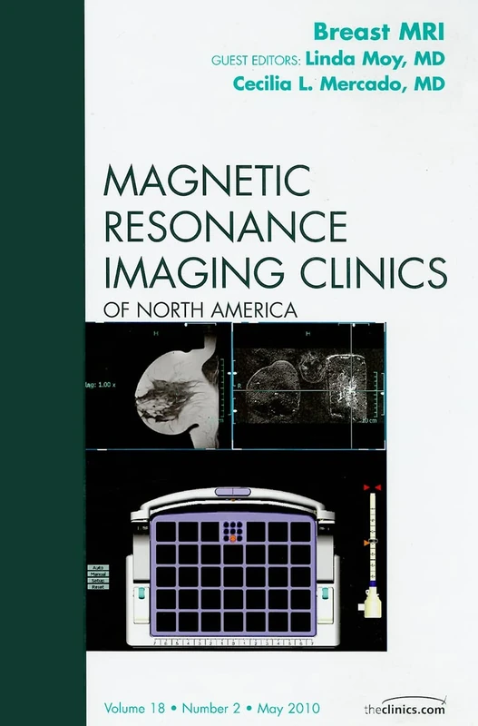 Breast MRI, An Issue of Magnetic Resonance Imaging Clinics (Volume 18-2) (The Clinics: Radiology, Volume 18-2)