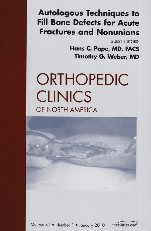Autologous Techniques to Fill Bone Defects for Acute Fractures and Nonunions, An Issue of Orthopedic Clinics (Volume 41-1) (The Clinics: Orthopedics, Volume 41-1)