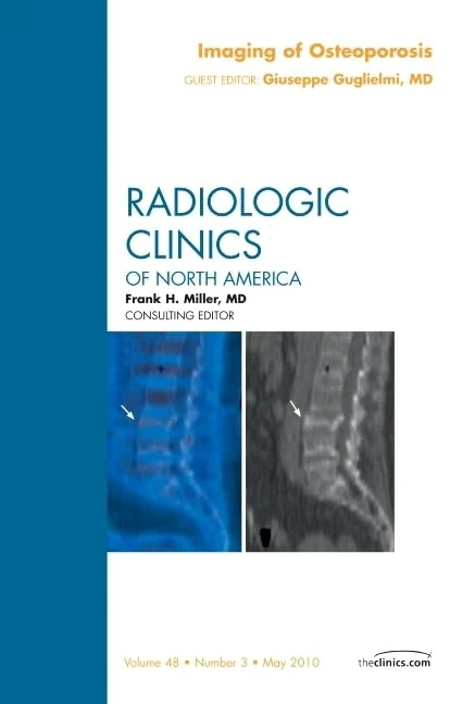 Imaging of Osteoporosis, An Issue of Radiologic Clinics of North America (Volume 48-3) (The Clinics: Radiology, Volume 48-3)