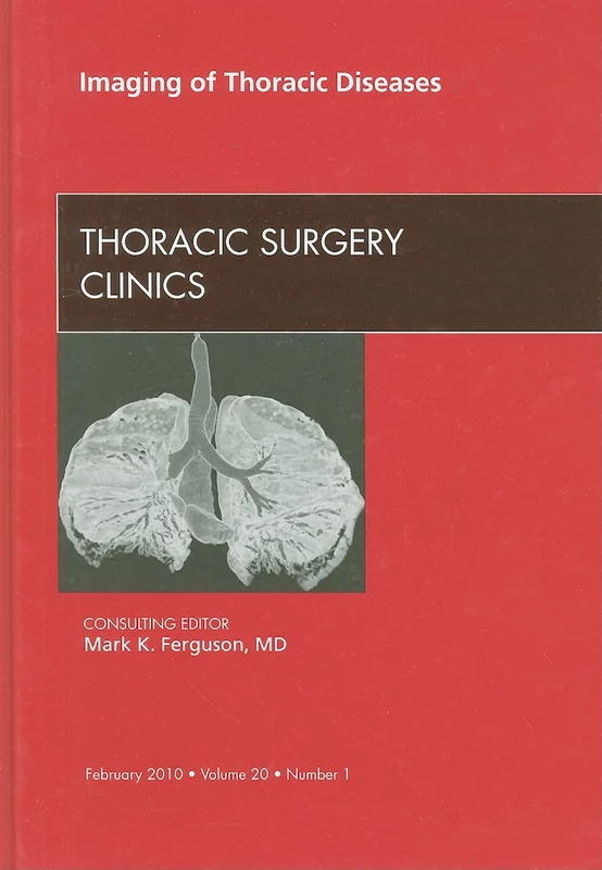 Imaging of Thoracic Diseases, An Issue of Thoracic Surgery Clinics (Volume 20-1) (The Clinics: Surgery, Volume 20-1)