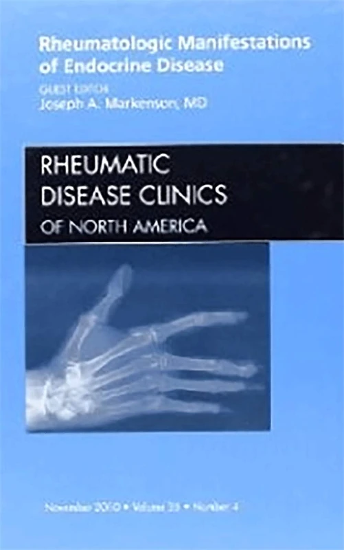 Rheumatologic Manifestations of Endocrine Disease, An Issue of Rheumatic Disease Clinics (Volume 36-4) (The Clinics: Internal Medicine, Volume 36-4)