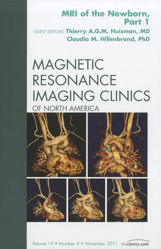 MRI of the Newborn, Part I, An Issue of Magnetic Resonance Imaging Clinics (Volume 19-4) (The Clinics: Radiology, Volume 19-4)