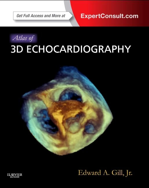 Atlas of 3D Echocardiography: Expert Consult - Online and Print