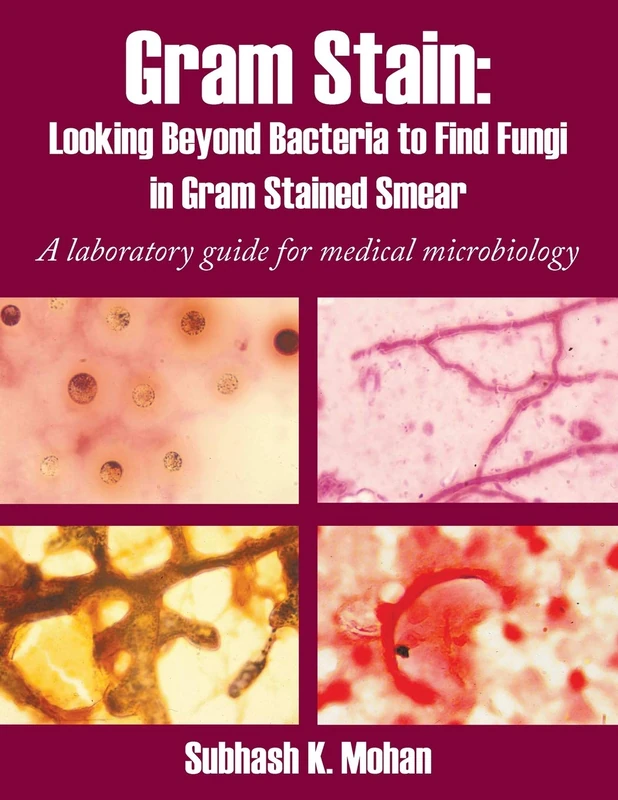 Gram Stain: Looking Beyond Bacteria to Find Fungi in Gram Stained Smear: A laboratory guide for medical microbiology