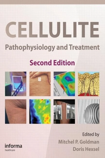 Cellulite: Pathophysiology and Treatment: 1 (Basic and Clinical Dermatology)