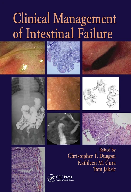 CRC Press - Clinical Management of Intestinal Failure Book
