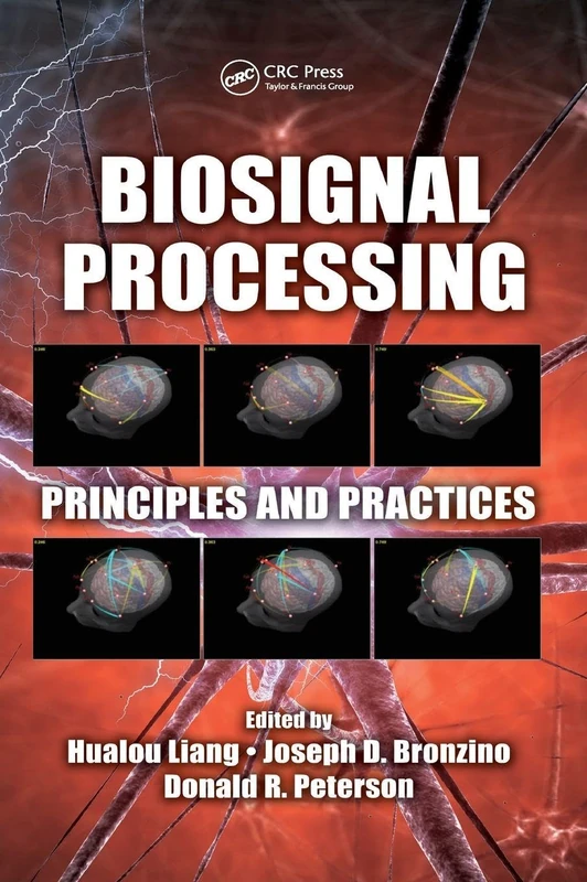 Biosignal Processing: Principles and Practices