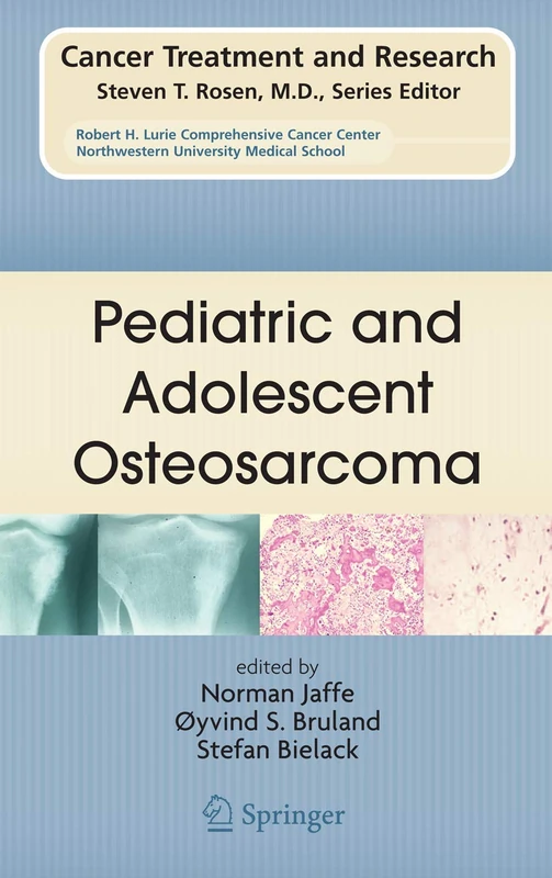 Pediatric and Adolescent Osteosarcoma: 152 (Cancer Treatment and Research, 152)