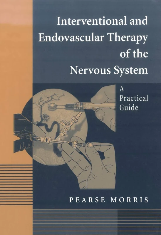 Interventional and Endovascular Therapy of the Nervous System: A Practical Guide - Image 1