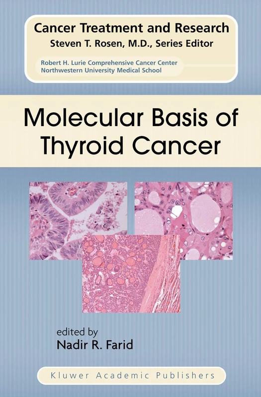 Molecular Basis of Thyroid Cancer: 122 (Cancer Treatment and Research, 122)