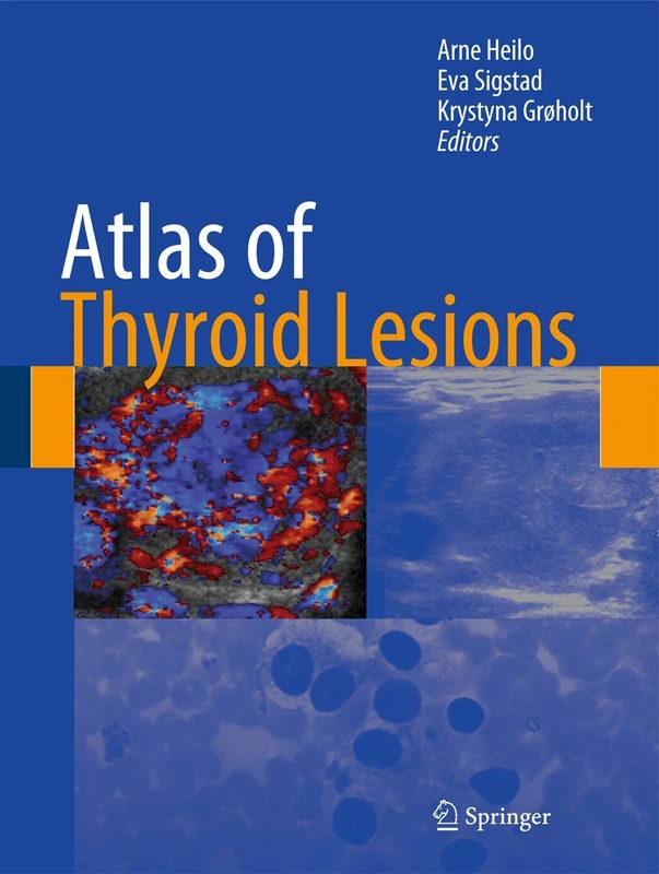Springer Atlas of Thyroid Lesions - Medical Reference Book