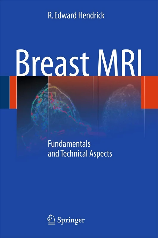 Breast MRI: Fundamentals and Technical Aspects - Image 1