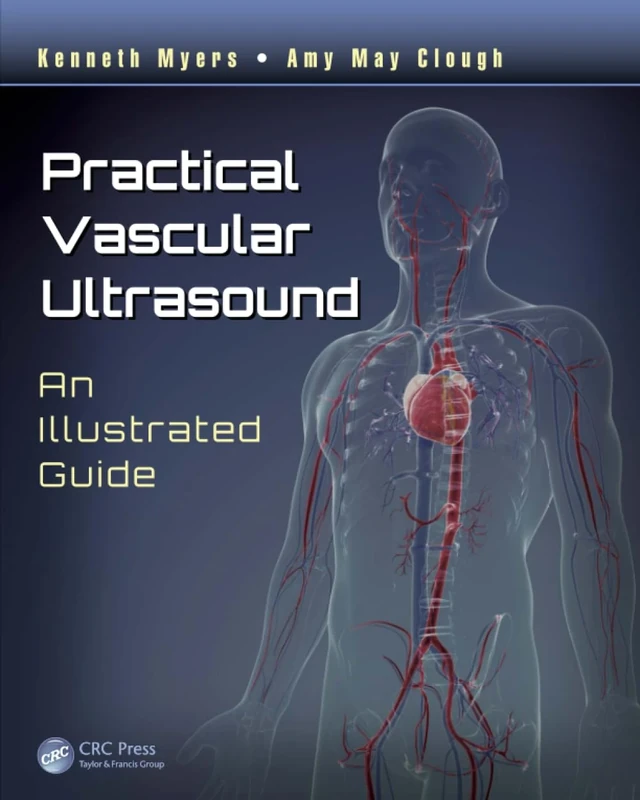 Practical Vascular Ultrasound: An Illustrated Guide