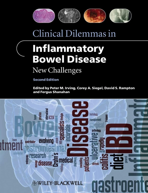 Clinical Dilemmas in Inflammatory Bowel Disease: New Challenges (Clinical Dilemmas (UK))