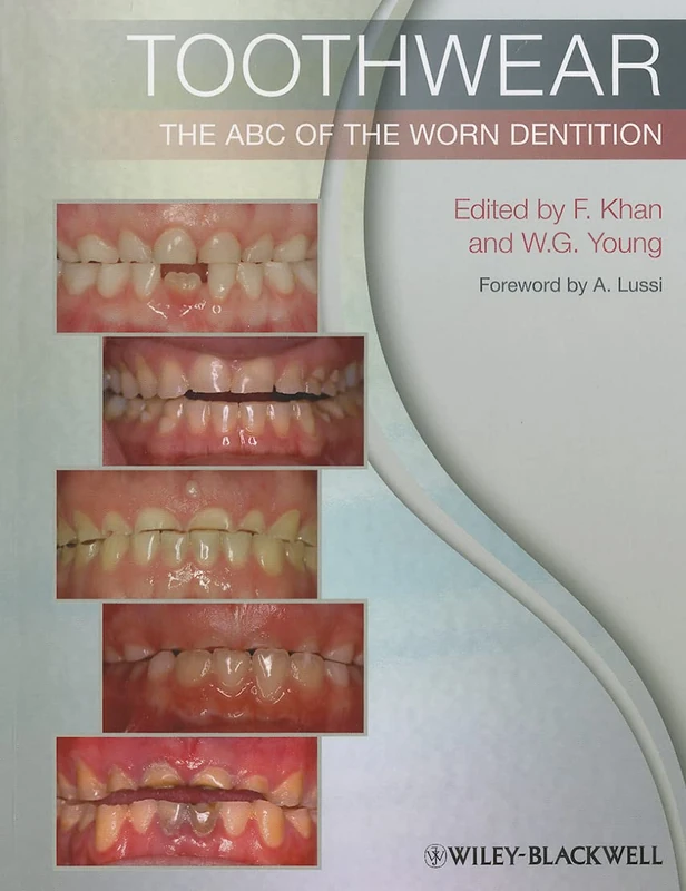 Toothwear: The ABC of the Worn Dentition
