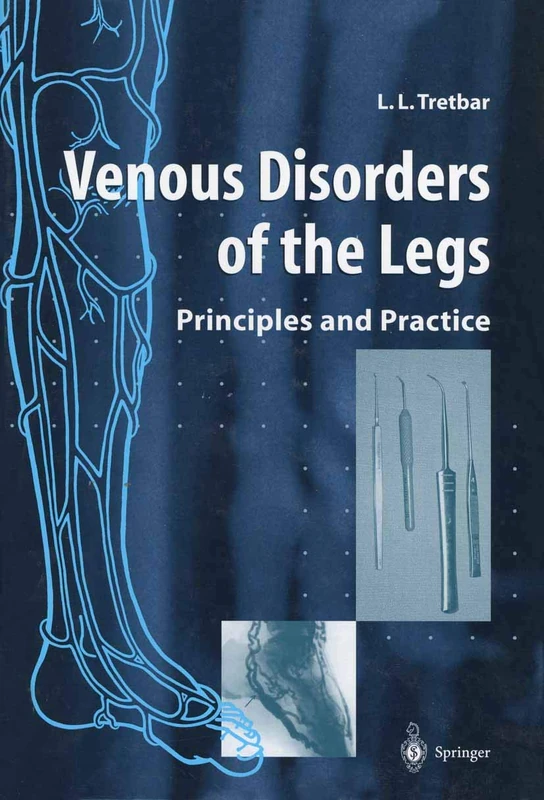 Venous Disorders of the Legs: Principles and Practice - Image 1