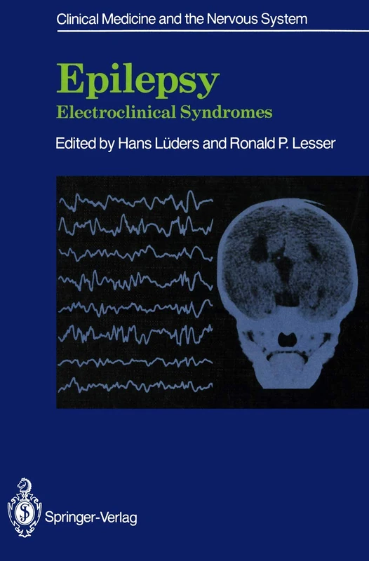 Epilepsy: Electroclinical Syndromes (Clinical Medicine and the Nervous System)