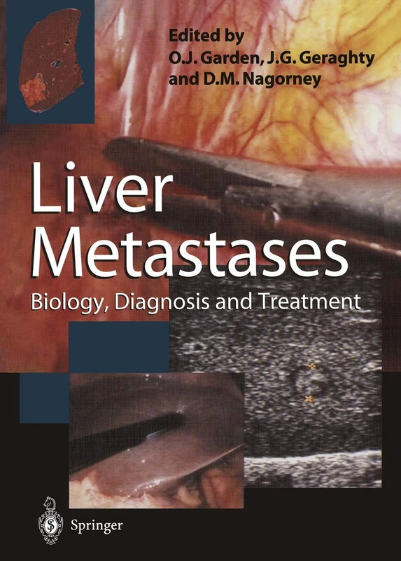Liver Metastases: Biology, Diagnosis and Treatment