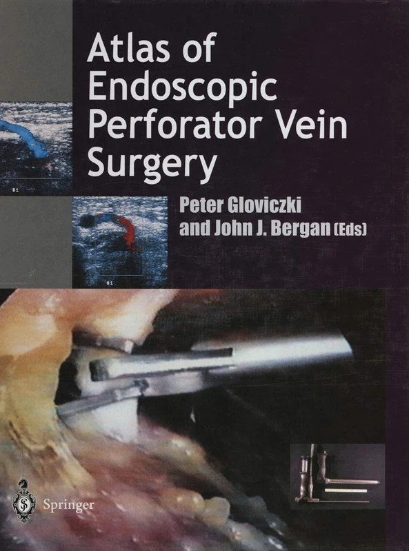 Atlas of Endoscopic Perforator Vein Surgery - Image 1