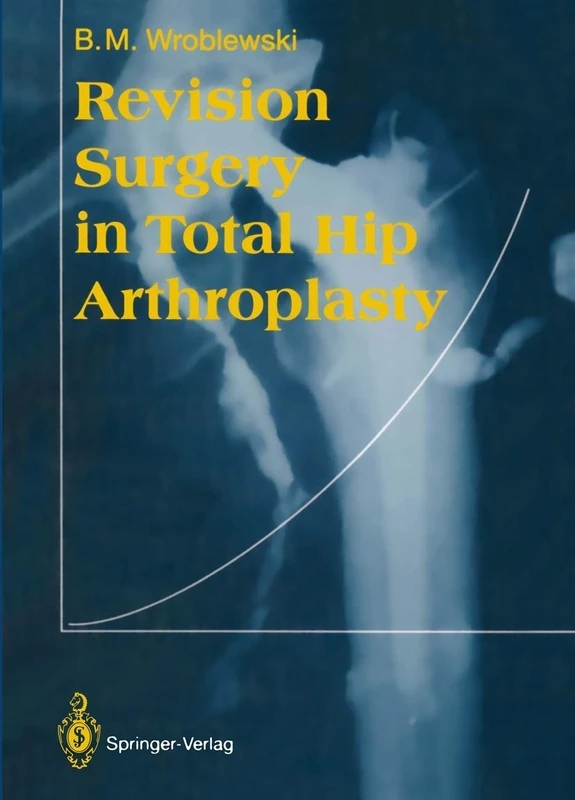 Springer - Revision Surgery in Total Hip Arthroplasty Book