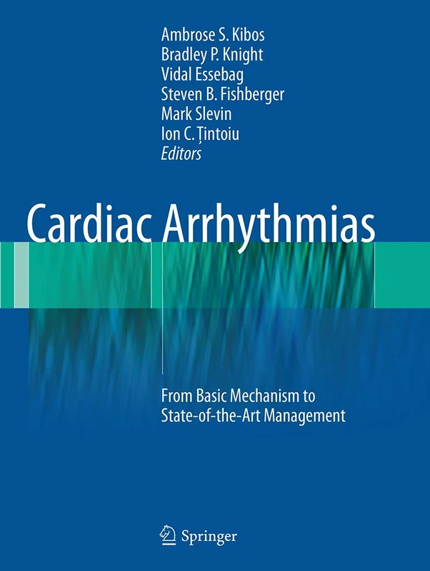 Springer Cardiac Arrhythmias - Management and Mechanisms