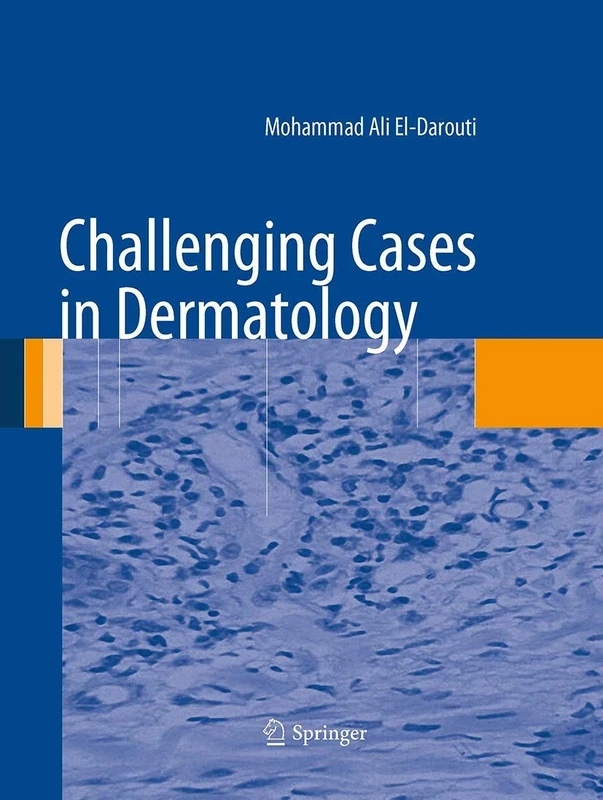 Challenging Cases in Dermatology