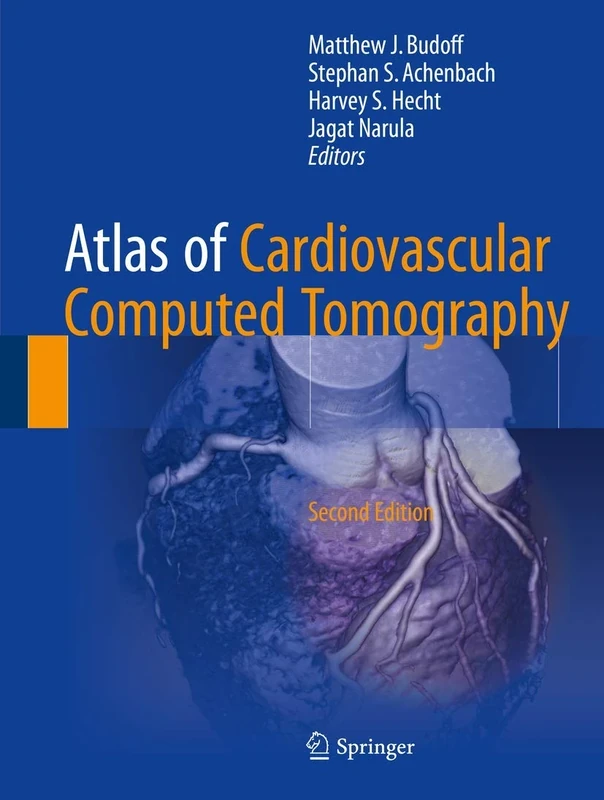 Atlas of Cardiovascular Computed Tomography