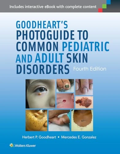 Goodheart's Photoguide to Common Pediatric and Adult Skin Disorders: Diagnosis and Management