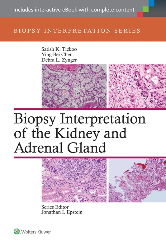 Biopsy Interpretation of the Kidney & Adrenal Gland (Biopsy Interpretation Series)