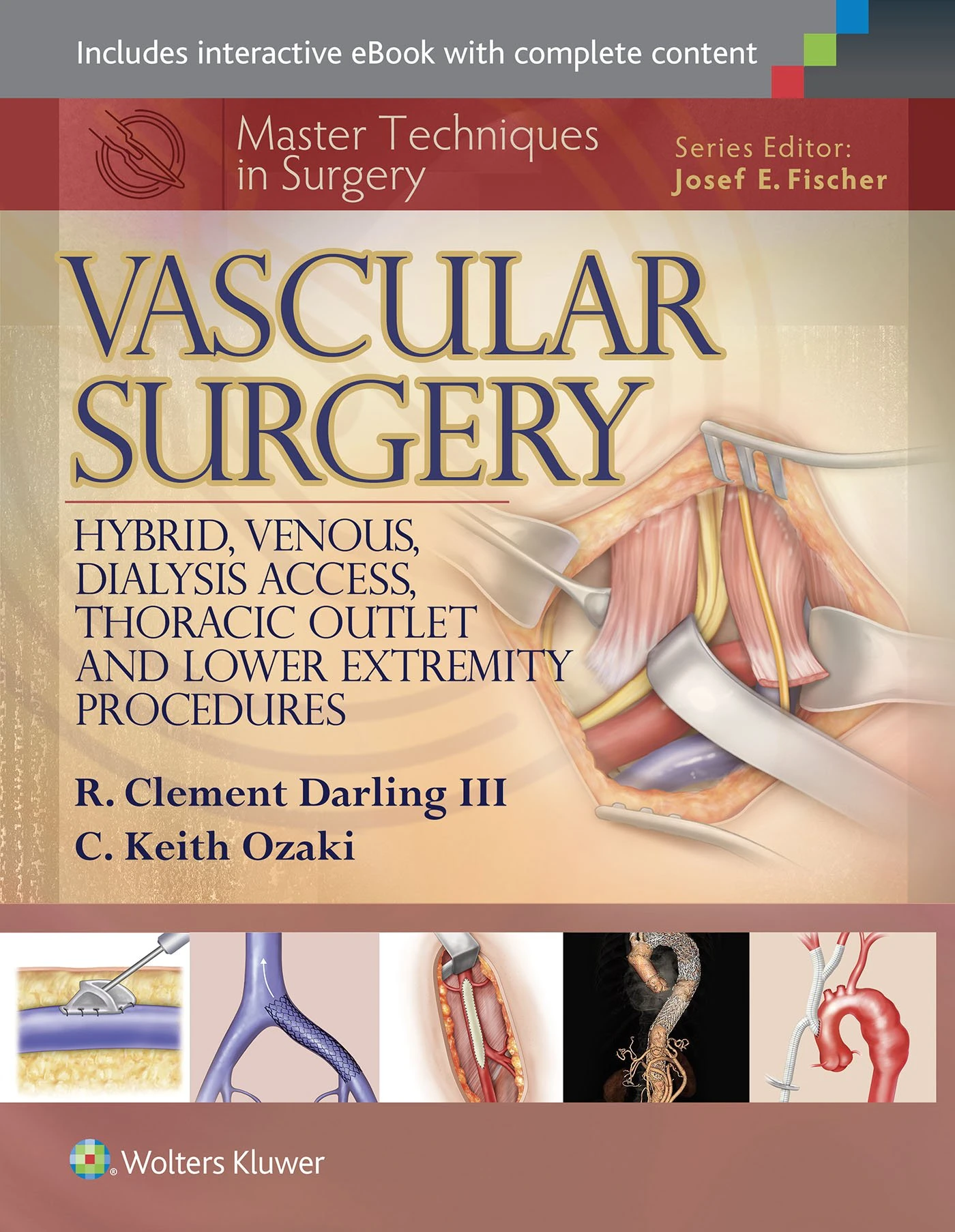Master Techniques in Surgery: Vascular Surgery: Hybrid, Venous, Dialysis Access, Thoracic Outlet, and Lower Extremity Procedures: Vascular Surgery: ... Outlet, and Lower Extremity Procedures, 1e