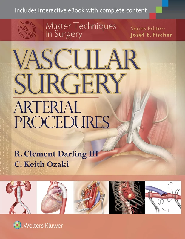 Master Techniques in Surgery: Vascular Surgery: Arterial Procedures: Vascular Surgery: Arterial Procedures, 1e