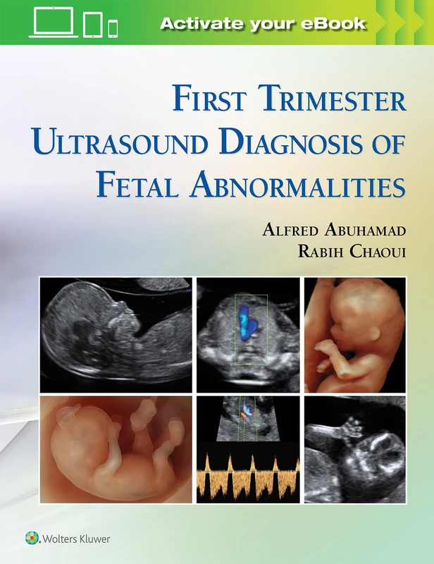 Lippincott First Trimester Ultrasound Diagnosis Reference Book