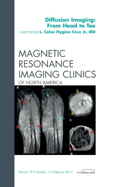 Clinical Applications of Diffusion Imaging: from Head to Toe, An Issue of Magnetic Resonance Imaging Clinics (Volume 19-1) (The Clinics: Radiology, Volume 19-1)