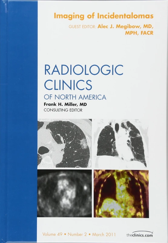 Imaging of Incidentalomas, An Issue of Radiologic Clinics of North America (Volume 49-2) (The Clinics: Radiology, Volume 49-2)