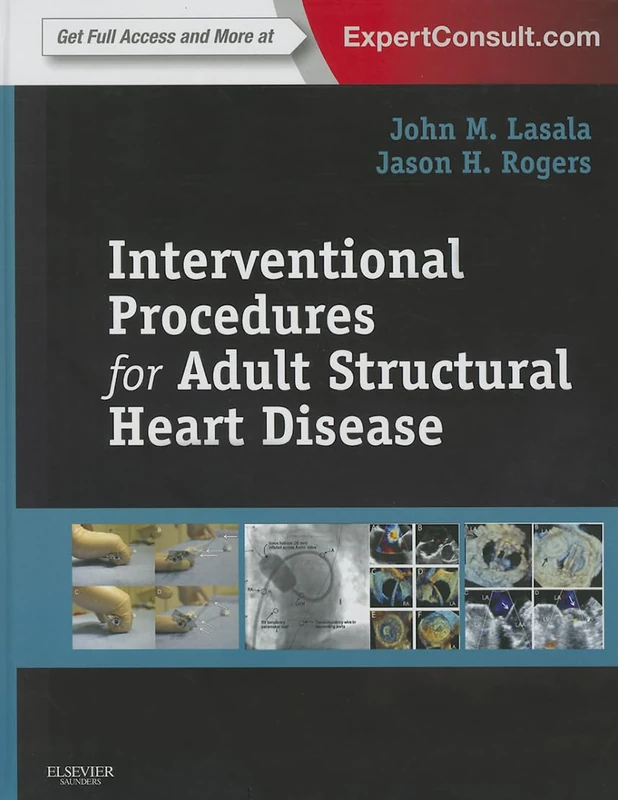 Interventional Procedures for Adult Structural Heart Disease - Image 1