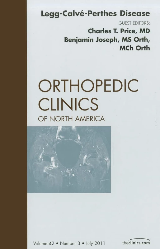 Perthes Disease, An Issue of Orthopedic Clinics (Volume 42-3) (The Clinics: Orthopedics, Volume 42-3)