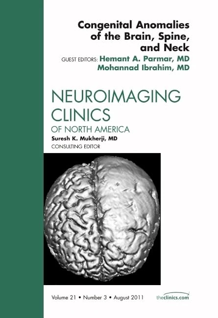 Congenital Anomalies of the Brain, Spine, and Neck, An Issue of Neuroimaging Clinics (Volume 21-3) (The Clinics: Radiology, Volume 21-3)